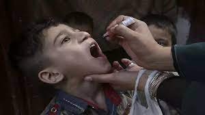 ISLAMABAD : First case of polio in Pakistan in 2023
