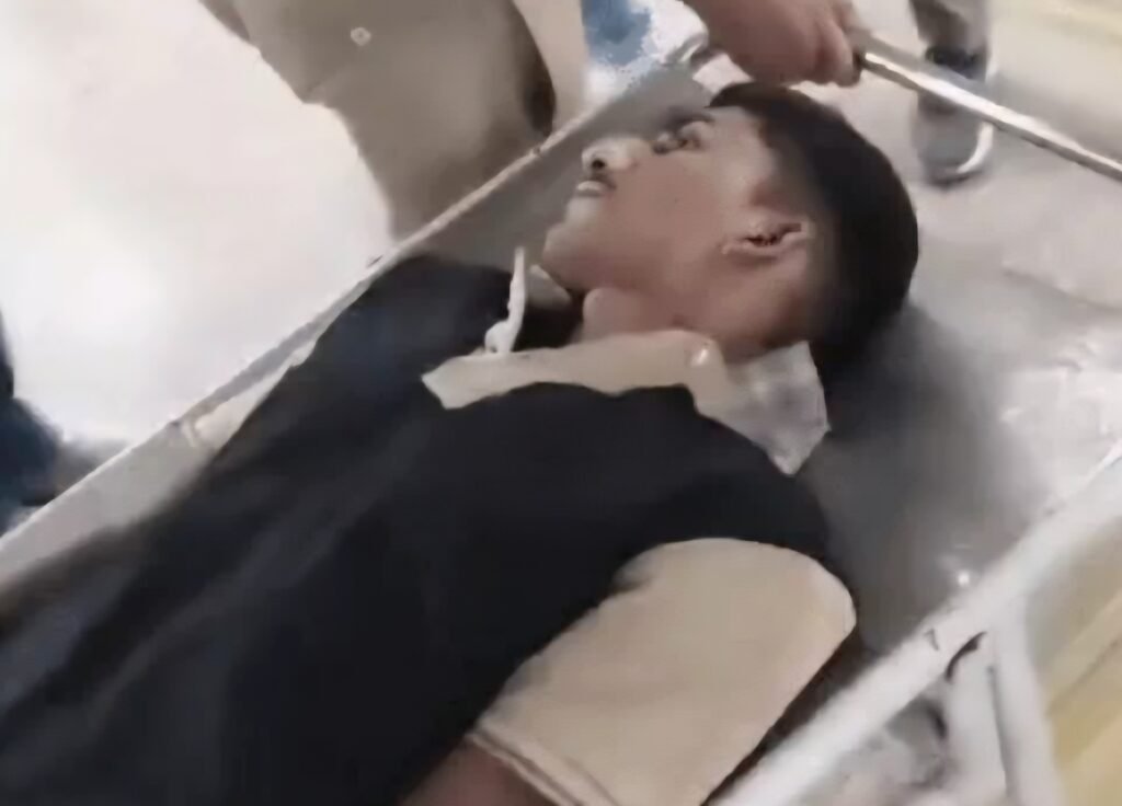 Yamunanagar: Firing Incident Accused Jumps from Custody; Injured During Police Operation